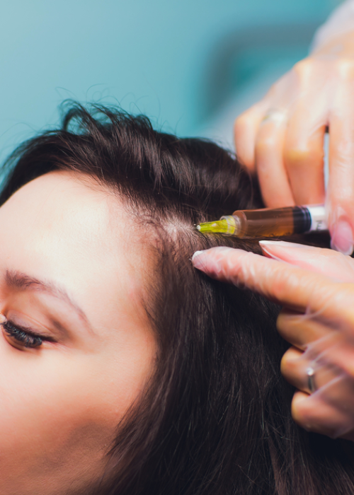 Muscular-Skelator-hair-restoration-23