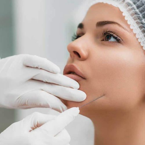 threads-face-neck-lift